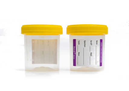 DispoZ 60mL, PP Specimen Container with Label, Yellow Cap(PE), Sterile